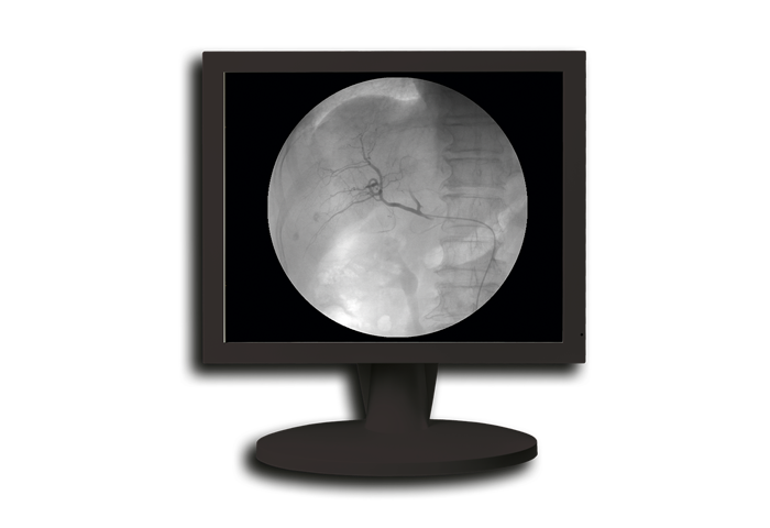 1MP Mono 19"(ODM only)