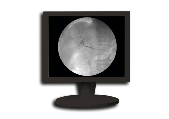 1MP_Mono_P_700X480